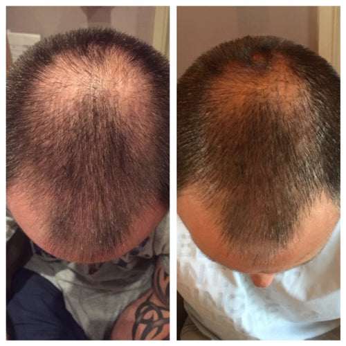 Amalian Hair Booster image 1